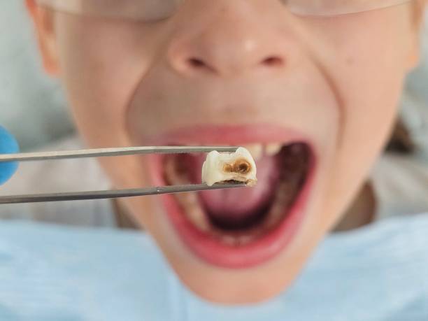Best Emergency Dental Care for Trauma or Injury in Crescent Springs, KY