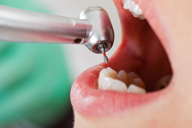 Best Emergency Dental Surgery in Crescent Springs, KY